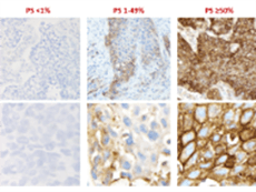 Staining slide of PD-L1 expression